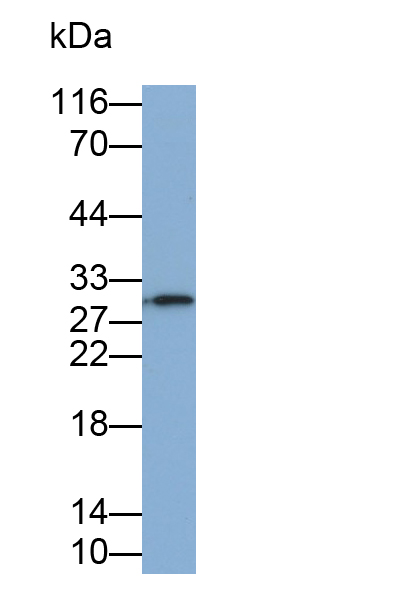 Monoclonal Antibody to Interleukin 35 (IL35)