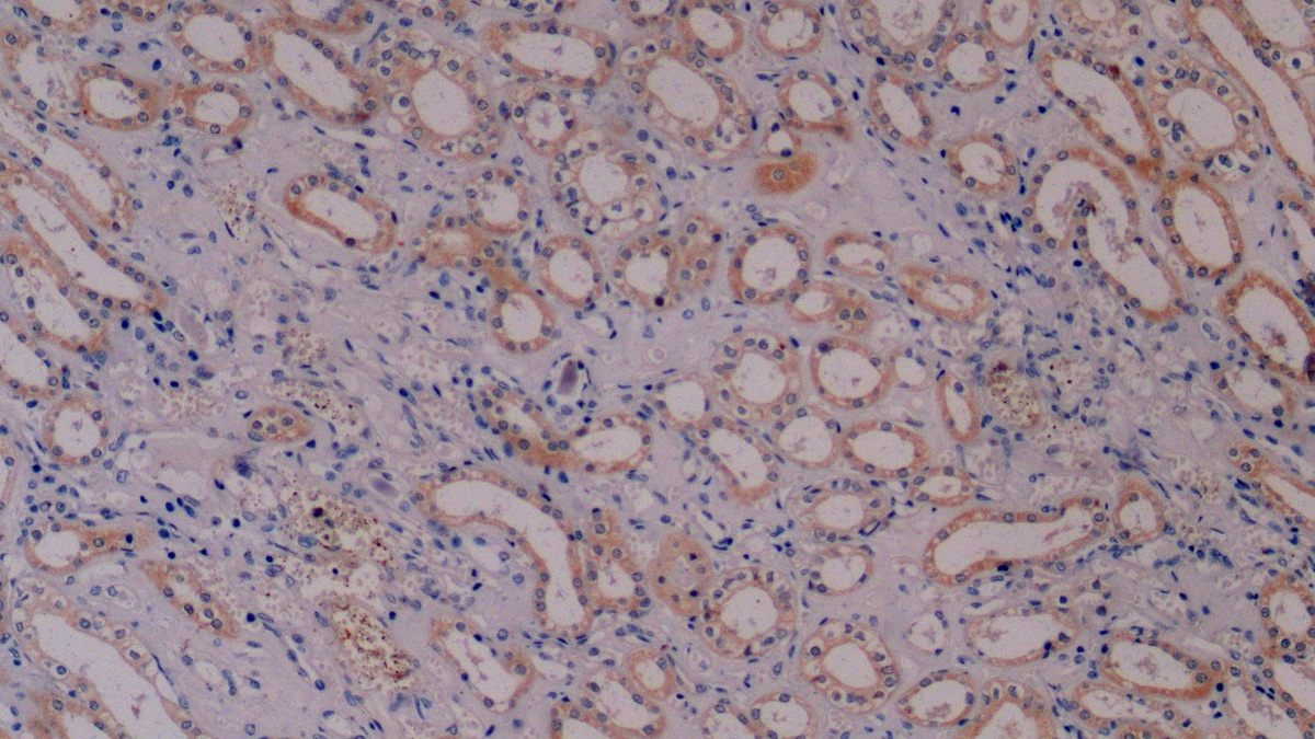 Monoclonal Antibody to Cytokeratin 8 (CK8)