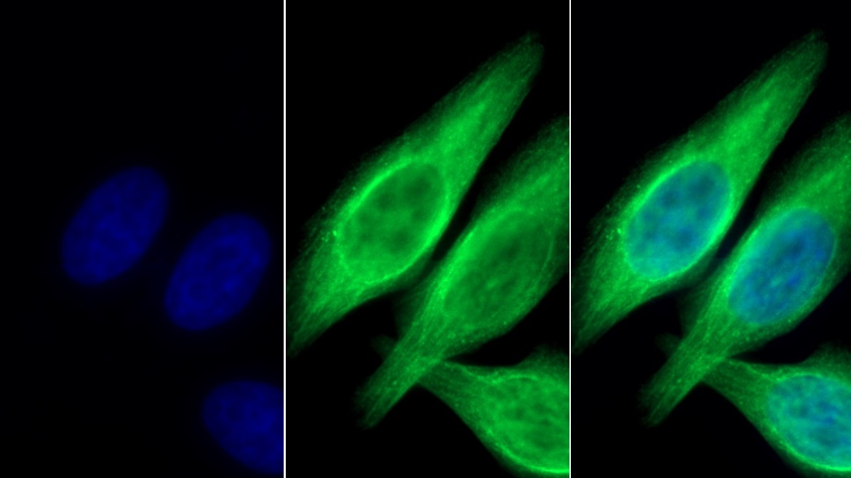 Monoclonal Antibody to Cytokeratin 8 (CK8)