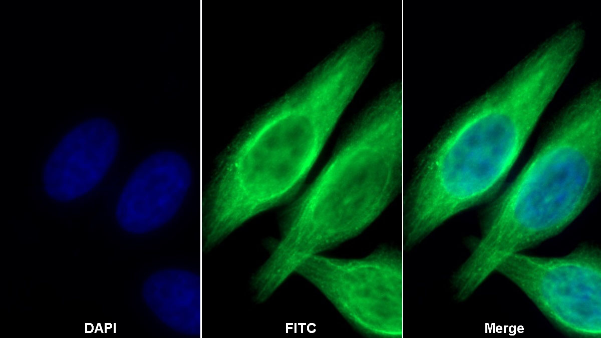 Monoclonal Antibody to Cytokeratin 8 (CK8)