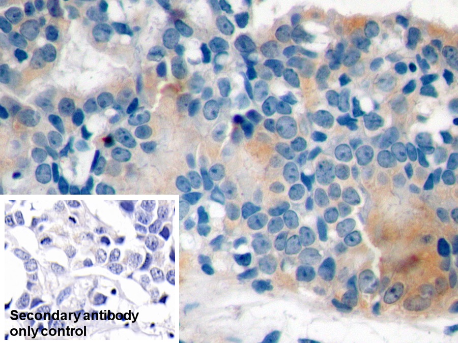 Monoclonal Antibody to Cytokeratin 8 (CK8)