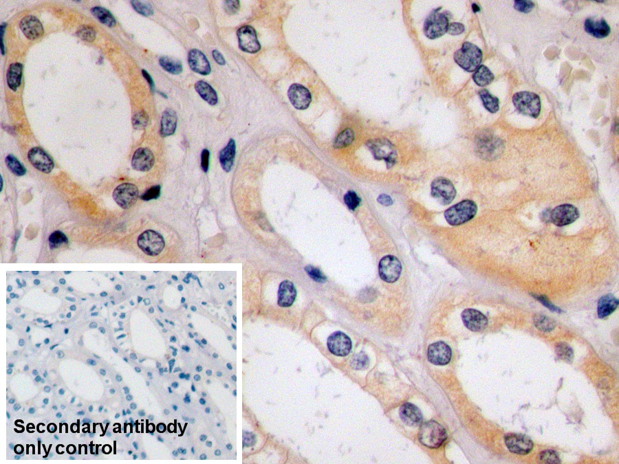 Monoclonal Antibody to Cytokeratin 8 (CK8)