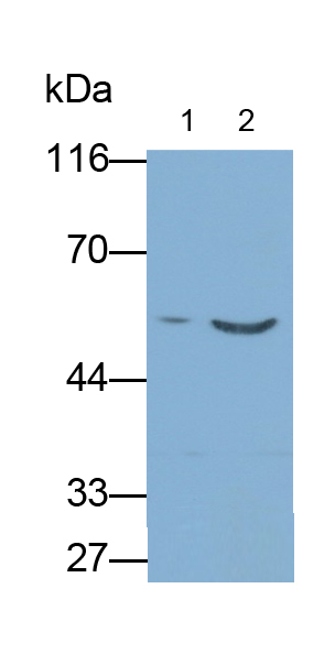 Monoclonal Antibody to Cytokeratin 8 (CK8)