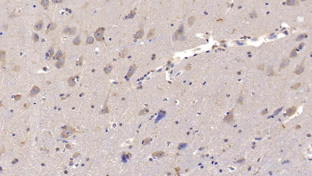 Monoclonal Antibody to Interleukin 29 (IL29)