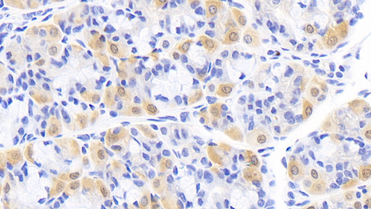 Monoclonal Antibody to Creatine Kinase B (CK-BB)