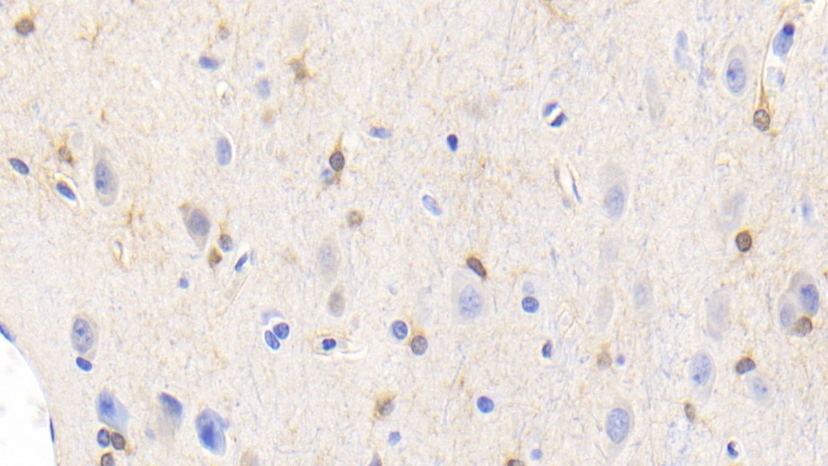 Monoclonal Antibody to Creatine Kinase B (CK-BB)