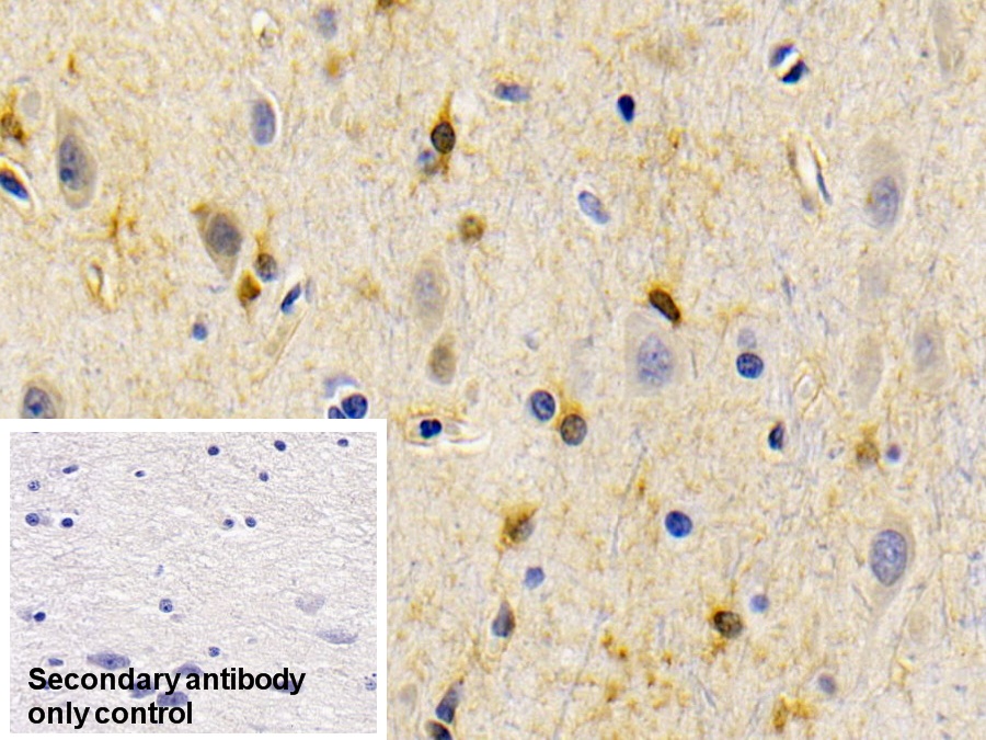 Monoclonal Antibody to Creatine Kinase B (CK-BB)