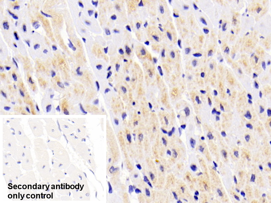 Monoclonal Antibody to Creatine Kinase B (CK-BB)