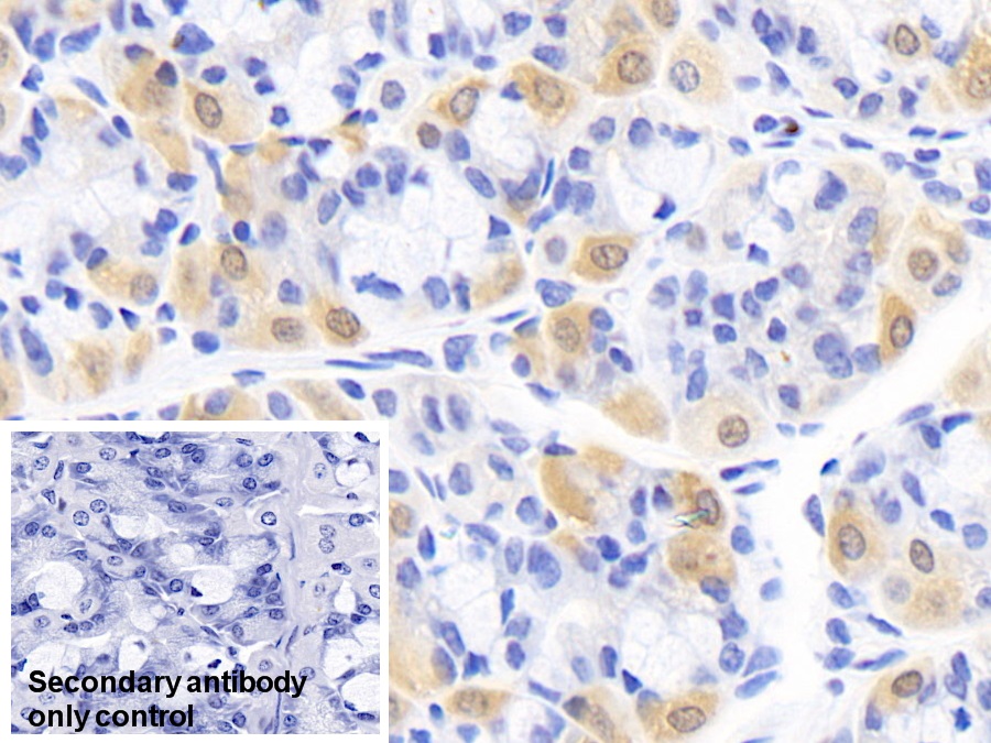 Monoclonal Antibody to Creatine Kinase B (CK-BB)