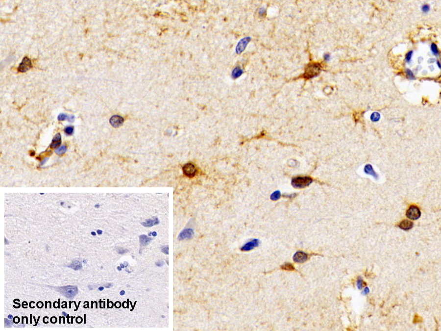 Monoclonal Antibody to Creatine Kinase B (CK-BB)