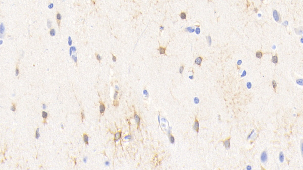 Monoclonal Antibody to Creatine Kinase B (CK-BB)