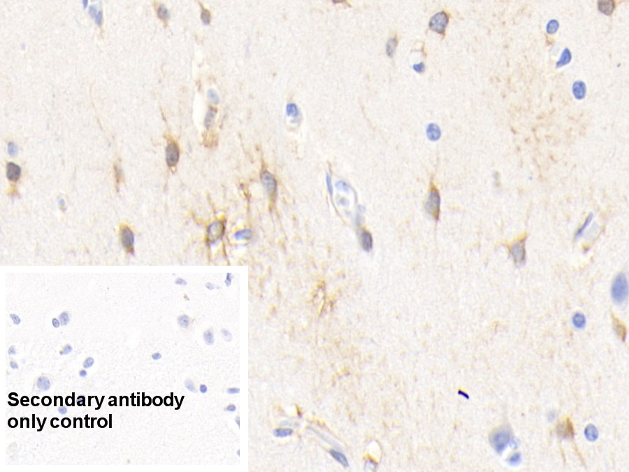 Monoclonal Antibody to Creatine Kinase B (CK-BB)