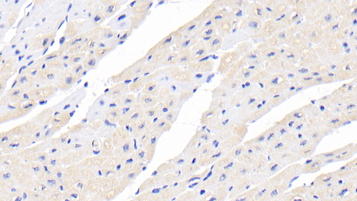 Monoclonal Antibody to Creatine Kinase B (CK-BB)