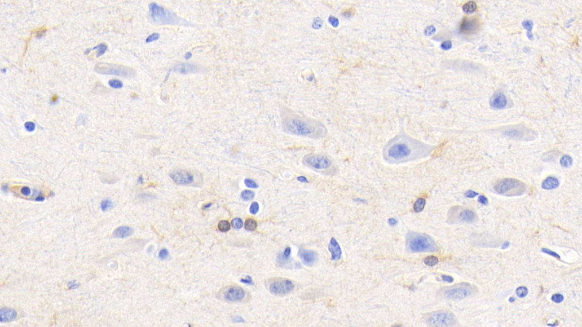 Monoclonal Antibody to Creatine Kinase B (CK-BB)