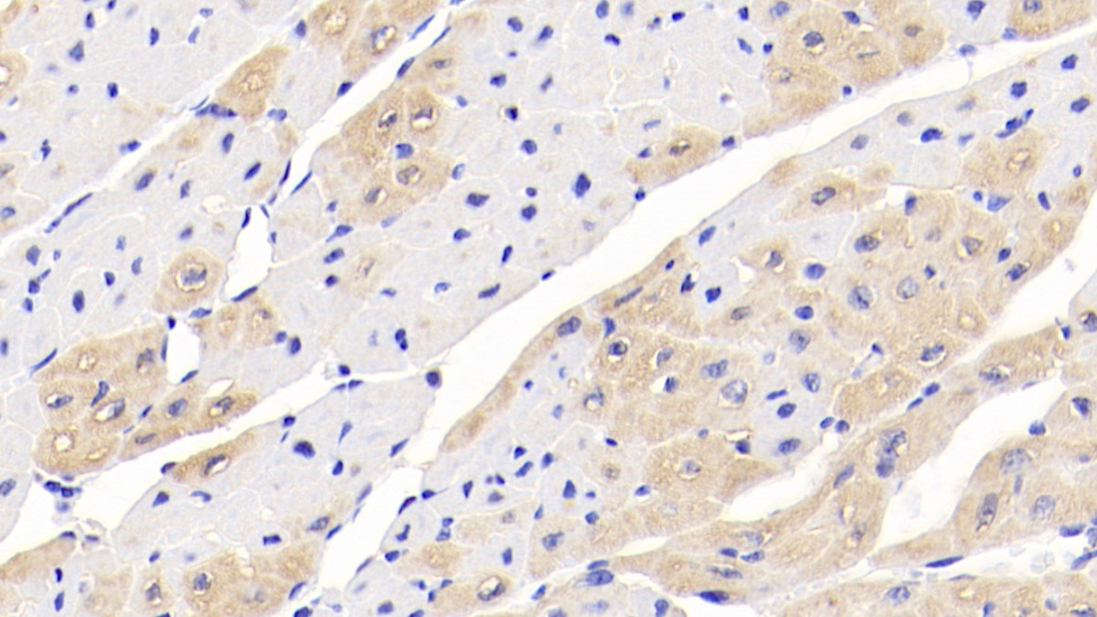 Monoclonal Antibody to Creatine Kinase B (CK-BB)