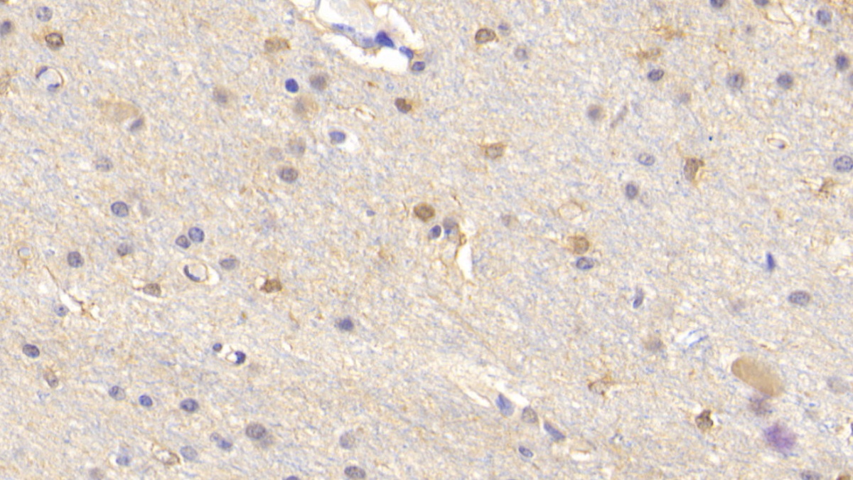 Monoclonal Antibody to Creatine Kinase B (CK-BB)