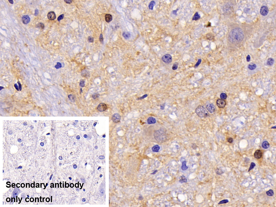 Monoclonal Antibody to Creatine Kinase B (CK-BB)