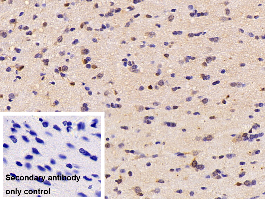 Monoclonal Antibody to Creatine Kinase B (CK-BB)