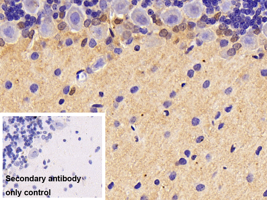 Monoclonal Antibody to Creatine Kinase B (CK-BB)