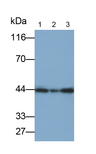 Monoclonal Antibody to Creatine Kinase B (CK-BB)