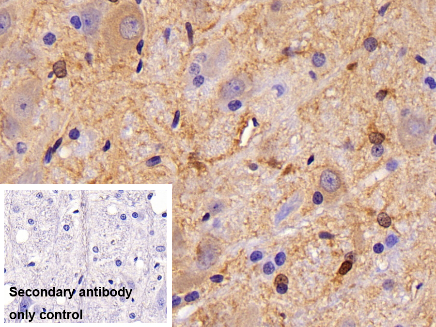 Monoclonal Antibody to Creatine Kinase B (CK-BB)