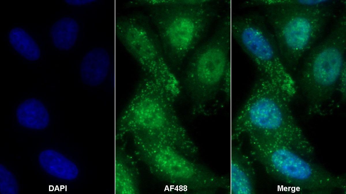 Monoclonal Antibody to Growth Differentiation Factor 15 (GDF15)