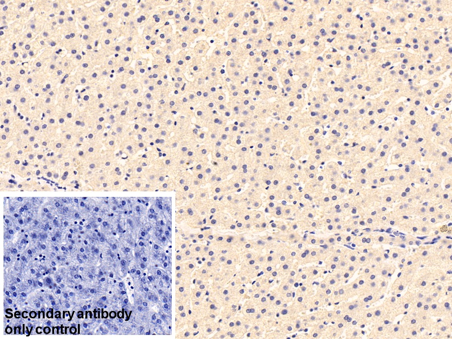 Monoclonal Antibody to Transferrin (TF)