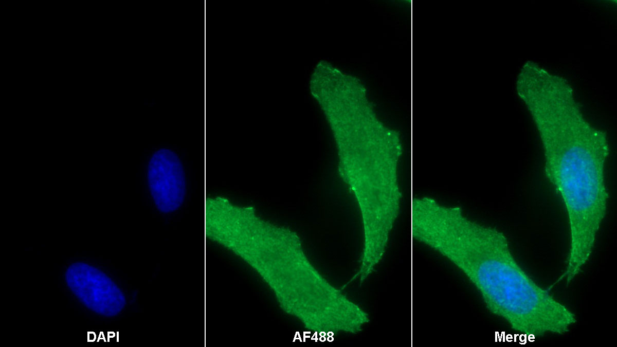 Monoclonal Antibody to Transferrin (TF)