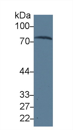 Monoclonal Antibody to Transferrin (TF)