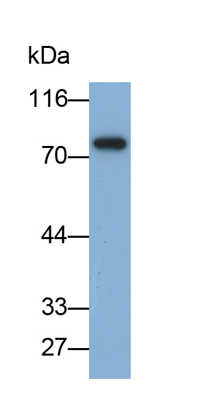 Monoclonal Antibody to Transferrin (TF)