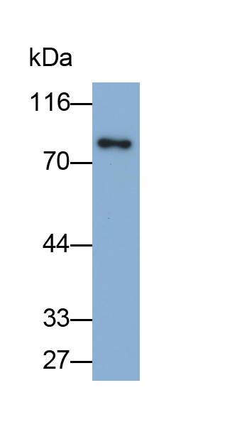 Monoclonal Antibody to Transferrin (TF)