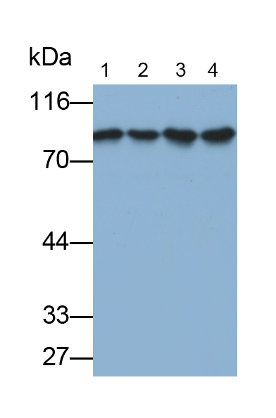 Monoclonal Antibody to Transferrin (TF)