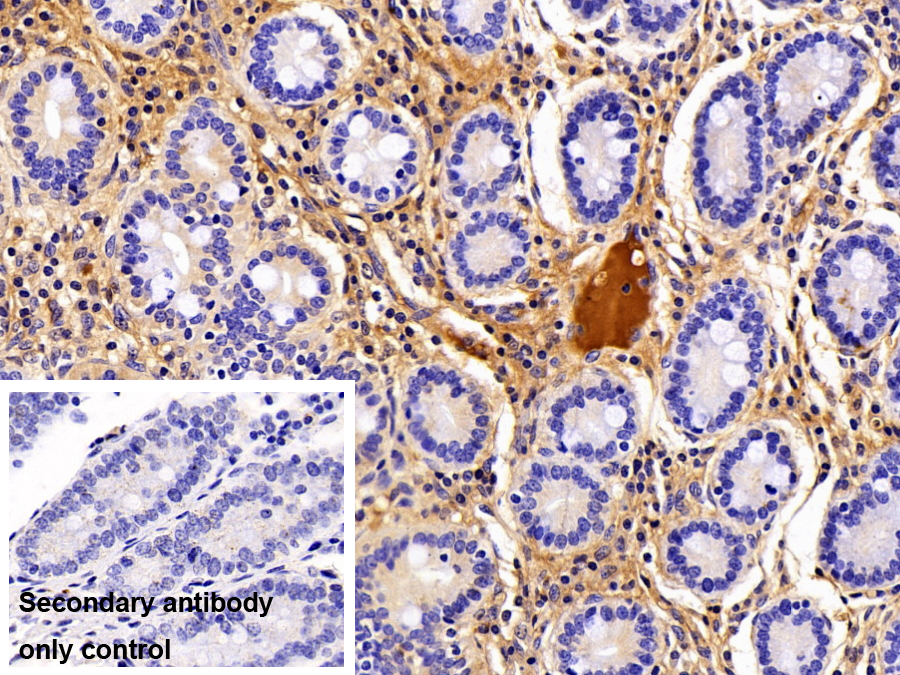 Monoclonal Antibody to Transferrin (TF)