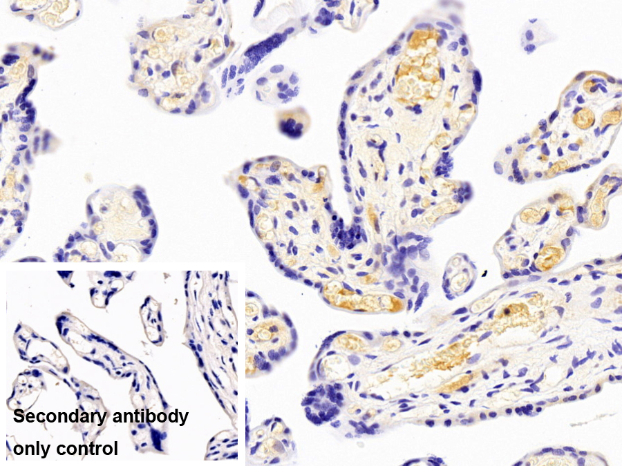 Monoclonal Antibody to Transferrin (TF)