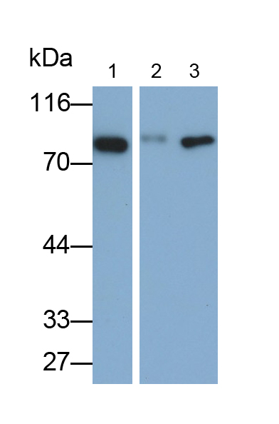 Monoclonal Antibody to Transferrin (TF)