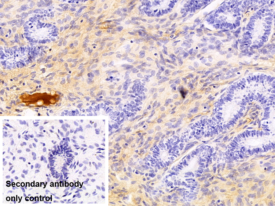 Monoclonal Antibody to Transferrin (TF)