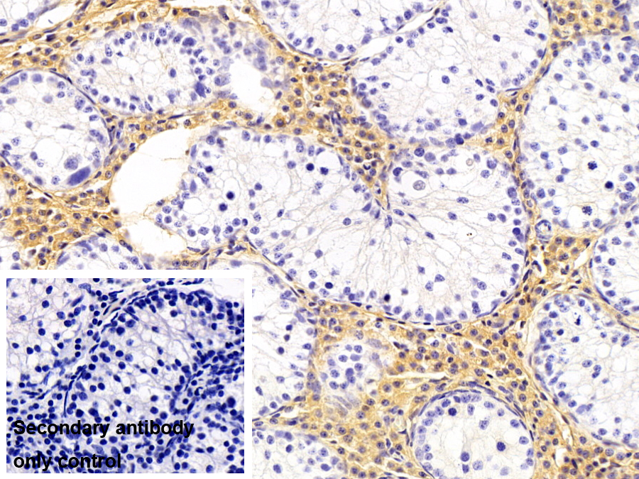 Monoclonal Antibody to Transferrin (TF)