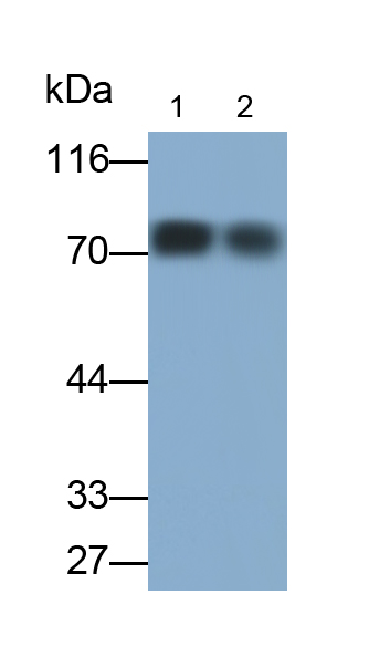 Monoclonal Antibody to Transferrin (TF)