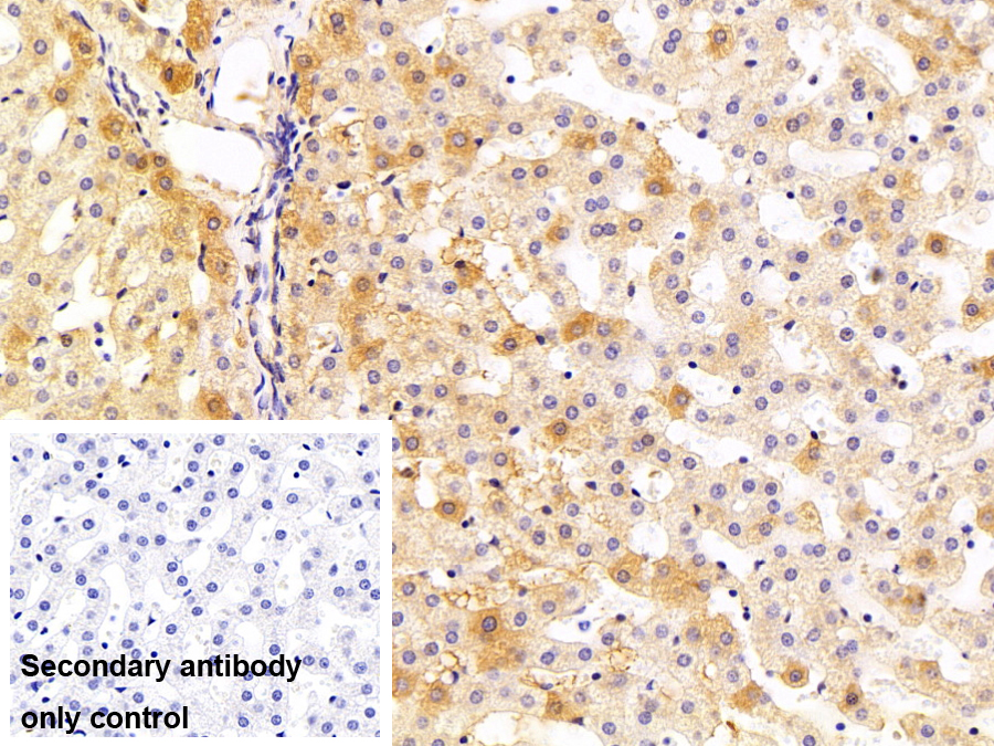 Monoclonal Antibody to Transferrin (TF)