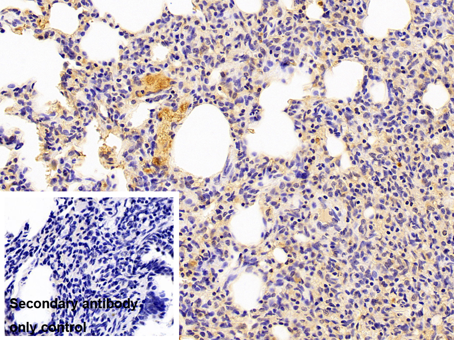 Monoclonal Antibody to Transferrin (TF)