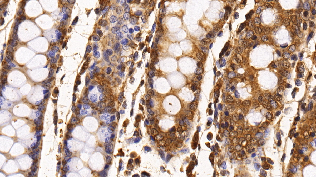 Monoclonal Antibody to Survivin (Surv)