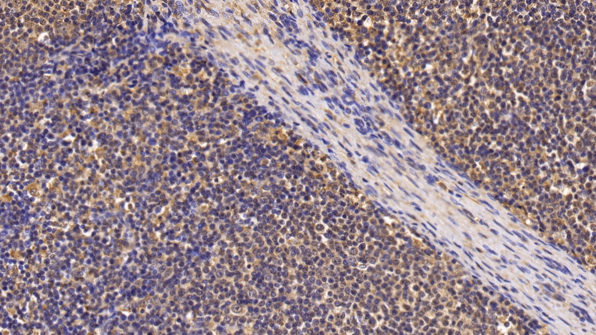 Monoclonal Antibody to Survivin (Surv)