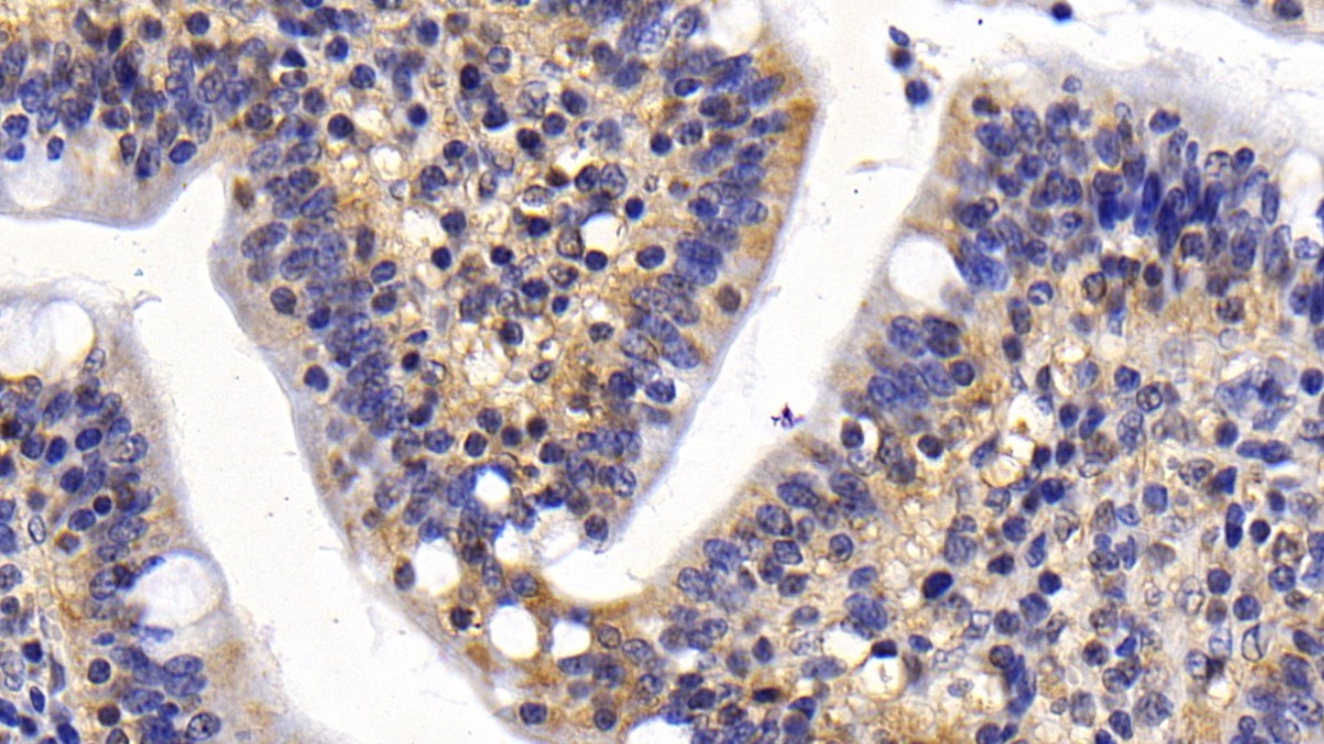 Monoclonal Antibody to Survivin (Surv)