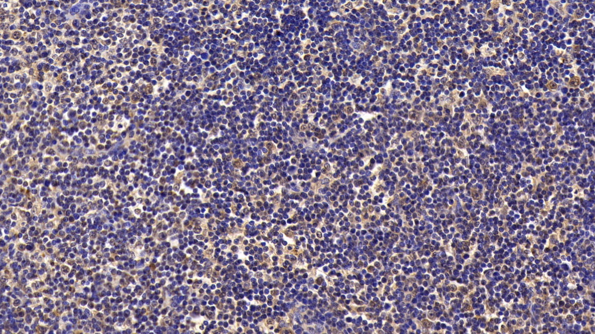 Monoclonal Antibody to Survivin (Surv)