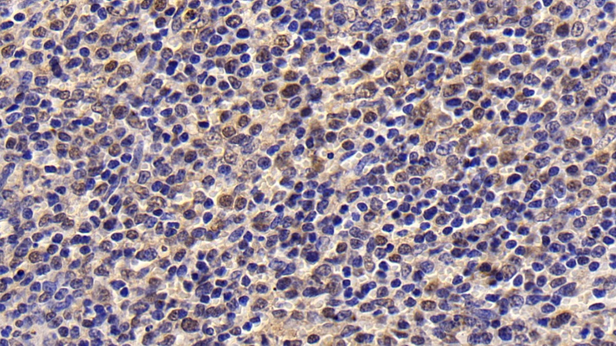 Monoclonal Antibody to Survivin (Surv)