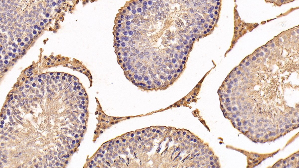 Monoclonal Antibody to S100 Calcium Binding Protein A10 (S100A10)