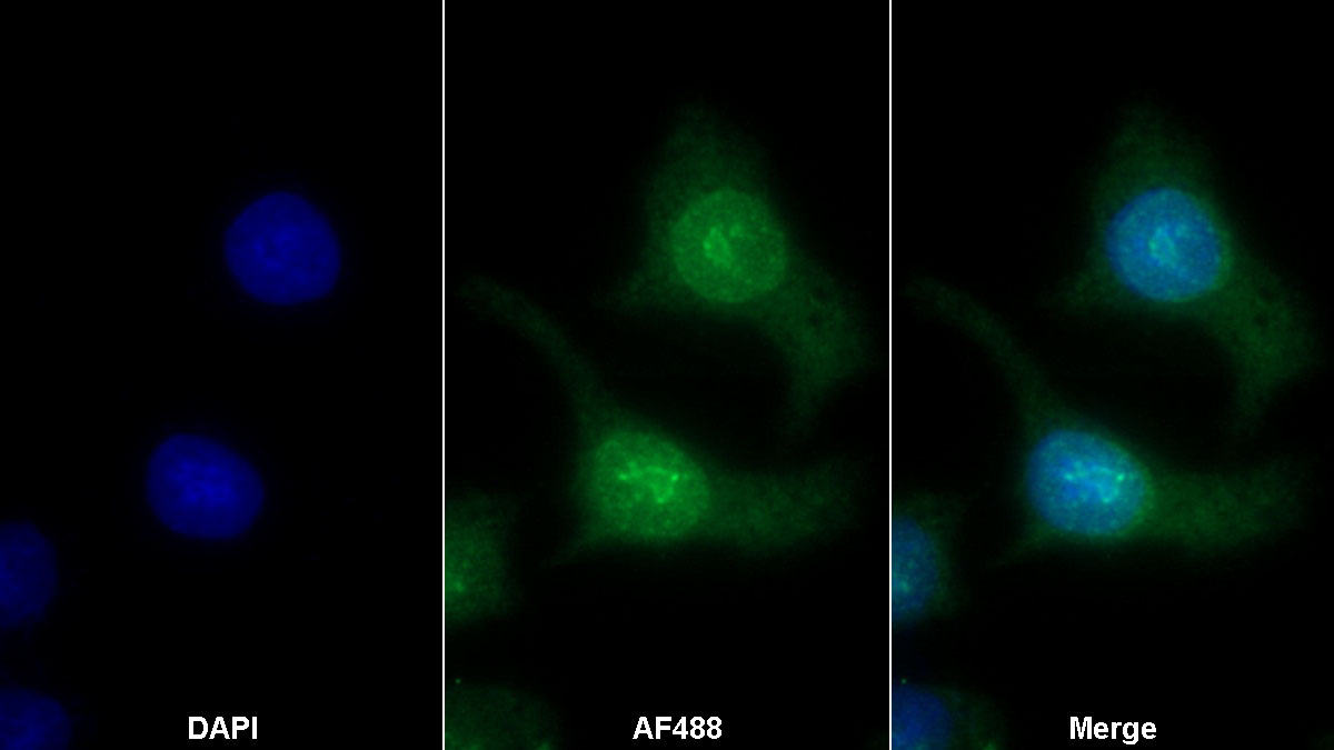 Monoclonal Antibody to Ki-67 Protein (Ki-67)