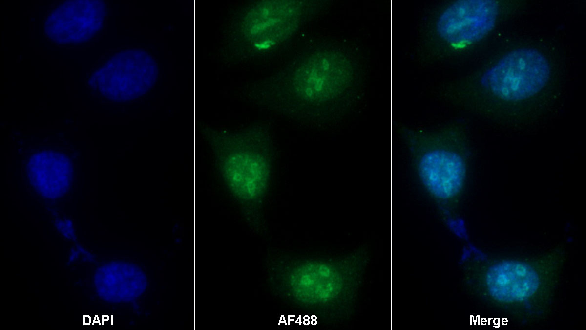 Monoclonal Antibody to Ki-67 Protein (Ki-67)