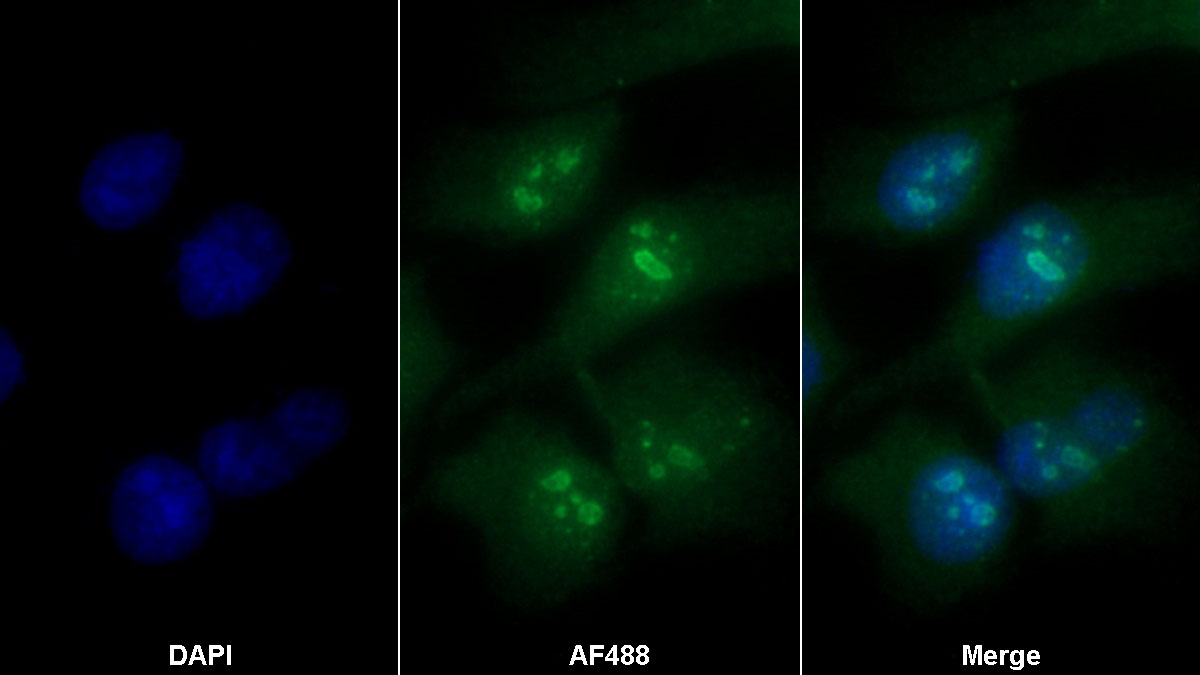 Monoclonal Antibody to Ki-67 Protein (Ki-67)