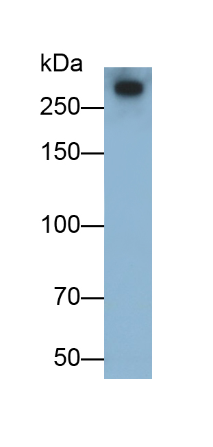 Monoclonal Antibody to Ki-67 Protein (Ki-67)